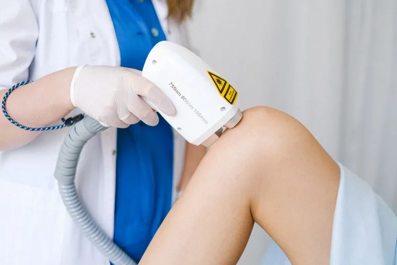 Fractional resurfacing laser