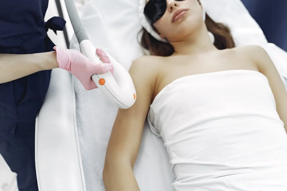 IPL photofacial light pulse