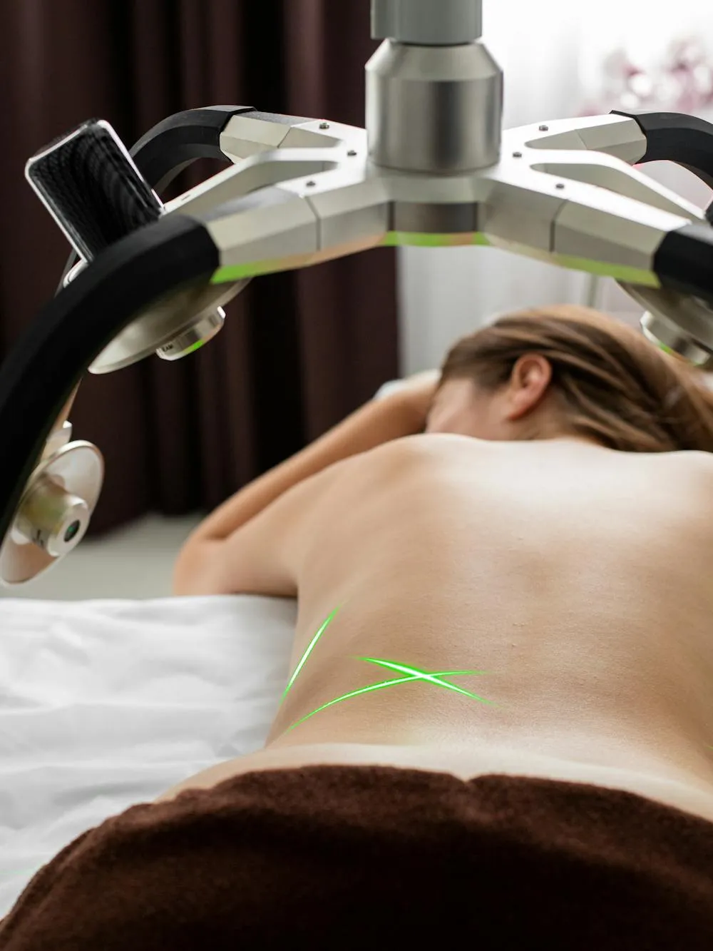 Diode laser hair removal machine