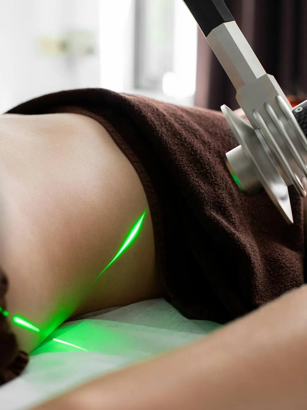 Fractional laser resurfacing device