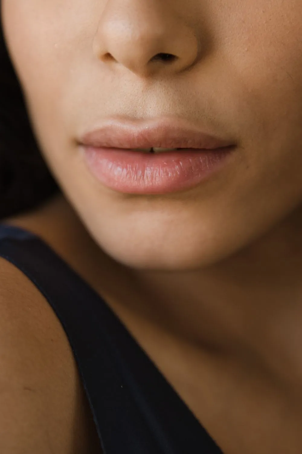 Lip filler result